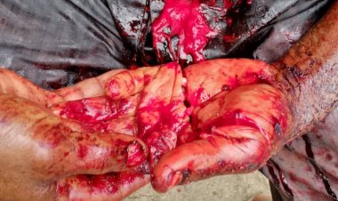 BREAKING: Fresh Tension Between Okuama, Akugbene in Delta, One Dead, 3 Wounded 